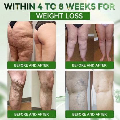 𝗭𝐖𝗘𝐄®🏅𝑮𝑳𝑷-1 7-𝑫𝒂𝒚 𝑮𝒖𝒕 𝑪𝒍𝒆𝒂𝒏𝒔𝒆 & 𝑺𝒍𝒊𝒎 𝑺𝒖𝒑𝒑𝒐𝒓𝒕 𝑶𝒓𝒂𝒍 𝑺𝒐𝒍𝒖𝒕𝒊𝒐𝒏-(𝐎𝐧𝐜𝐞 𝐚 𝐝𝐚𝐲, 𝐫𝐞𝐬𝐮𝐥𝐭𝐬 𝐢𝐧 𝟕 𝐝𝐚𝐲𝐬), 𝑾𝒊𝒕𝒉 10 𝑩𝒊𝒍𝒍𝒊𝒐𝒏 𝑪𝑭𝑼 𝑨𝒄𝒕𝒊𝒗𝒆 𝑷𝒓𝒐𝒃𝒊𝒐𝒕𝒊𝒄𝒔, 𝑺𝒖𝒑𝒑𝒐𝒓𝒕𝒔 𝒘𝒆𝒊𝒈𝒉𝒕 𝒎𝒂𝒏𝒂𝒈𝒆𝒎𝒆𝒏𝒕, 𝒉𝒆𝒂𝒓𝒕 𝒉𝒆𝒂𝒍𝒕𝒉, 𝒅𝒊𝒂𝒃𝒆𝒕𝒆𝒔, 𝒈𝒖𝒕 & 𝒘𝒐𝒎𝒆𝒏'𝒔 𝒉𝒆𝒂𝒍𝒕𝒉, 𝒇𝒊𝒓𝒎𝒊𝒏𝒈 𝒔𝒌𝒊𝒏,𝒘𝒉𝒊𝒍𝒆 𝒔𝒆𝒂𝒔𝒐𝒏𝒂𝒍 𝒊𝒎𝒎𝒖𝒏𝒆 𝒔𝒖𝒑𝒑𝒐𝒓𝒕